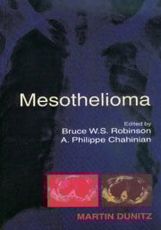 Mesothelioma: A Clinical Guide cover